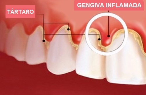 Periodontia - Oral Arte Odontologia