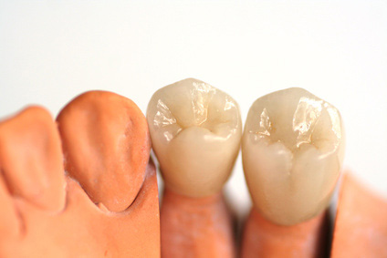 Reabilitação Oral (Prótese) - Oral Arte Odontologia