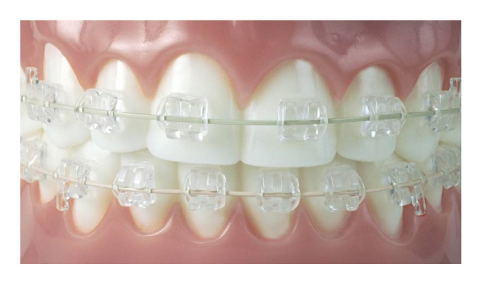 Ortodontia - Oral Arte Odontologia